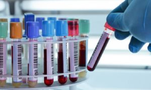 laboratorio analisi
