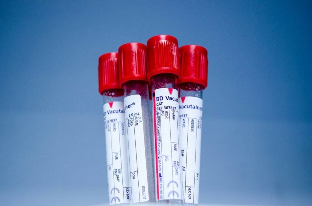 Esami del sangue e cortisolo